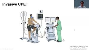 CTEPH Updates for Community Practitioners: The Pitfalls in Diagnosing CTEPH and CTEPD - Why Is It so Hard?