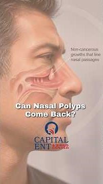 Can Nasal Polyps Come Back After Removal?