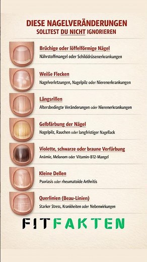 Warnsignale der Nägel ausführlich erklärt 💅⚠️ | Diese Veränderungen solltest du nicht ignorieren
