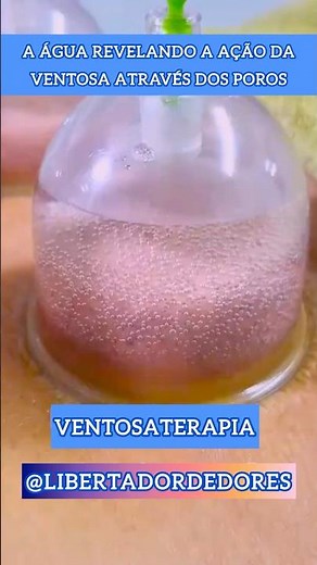 COMO FUNCIONA A VENTOSATERAPIA NO CORPO HUMANO #libertadordedores #ventosaterapia