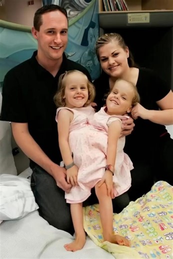 The conjoined twins were separated after a complex surgery. See what they look like 19 years later. The twins were born with a shared body and shared some organs. At the age of 4, with their parents’ consent, they underwent a complex separation surgery, although the doctors gave no guarantees of a successful outcome. The surgery lasted about 26 hours.😓😓 This was the first case in which doctors separated twins with shared organs. The surgery was successful, and the girls began to recover. Unfor