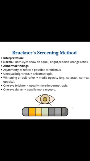 What is Bruckner's Screening Method ? . . Follow 👉 Optometry Club - A.K.D 👨‍⚕️🙏 #brucknersscreeningmethod #Bruckner #eyecare #EyeAwareness #ophthalmology #optometryclubakd #drakdwivedi #eyecaretips #optometrist #fbreels #reelsvideoシ #directophthalmoscope #ophthalmologist #ophthalmic #Eyesight #eyespecialist #Credit : Vision Scientist | Optometry Club - A.K.D