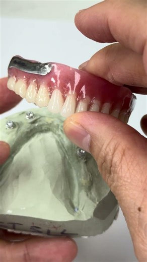 Super unique partial Dentures case!