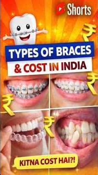 Which Braces are worth your money in India?l braces cost in India