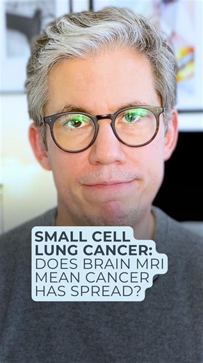 Dr James Wilson | Lung Cancer Specialist London on Instagram: "Something that surprises people with small cell lung cancer is how quickly and how often the conversation turns to your brain. That's not because we're being dramatic, it's because we're being thorough. → Why small cell lung cancer is different: Small cell lung cancer has a higher tendency than other cancer types to spread to the brain. → Two critical points about brain metastases in SCLC: 1. Brain spread can be completely silent You