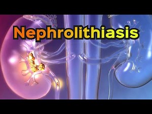 Nephrolithiasis (Kidney Stones) - CRASH! Medical Review Series
