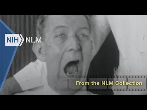 Pathological Laughing and Crying [Silent] (St. Elizabeths Hospital, 1930)