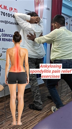 Best Ankylosing Spondylitis Exercises | Reduce Back Pain & Improve Spine Mobility