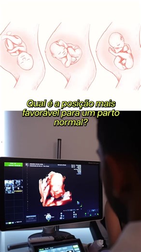 NÚCLEO APOIAR 🫂 on Instagram: "A posição favorável para o bebê nascer ajuda, mas não é, sozinha, o único fator que define a via de parto. Cada gestação é única, e a decisão envolve a avaliação de vários aspectos da saúde da mãe e do bebê. Por isso, o mais importante é ter um acompanhamento adequado e confiar na orientação do profissional que está acompanhando o seu pré-natal. #clinicainfantililheus #pediatrailheus #ginecologistailheus #obstetrailheus #dicasmaternidade #maternidade #maternidader