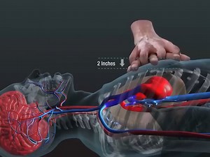 如发生心脏骤停时，紧急心肺复苏（CPR）和自动体外除颤器（AED）是关键的救命措施。CPR可以维持氧气流向大脑和其他器官，而AED可以帮助恢复正常的心律