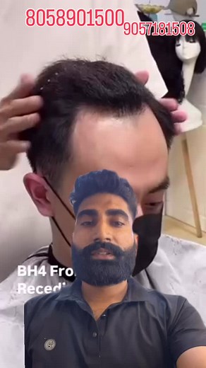 370 reactions · 22 comments | Hair patch………. . . . . #wigs #hair #wig #lacewigs #bundles #virginhair #wigmaker #lacefrontal #wiginstall #explorepage #hairstyles #humanhair #wigsforsale #hairstylist #hairextensions #frontal #customwigs #naturalhair #lacefrontwigs #closure #hdlace #frontalwigs #frontals #frontalsewin #straighthair #explore #curlyhair #wiglife #hairstyle #closurewig | Shabnam Scissor's Look | Facebook