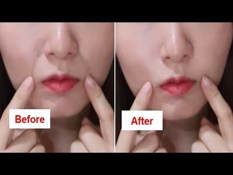 How To Get Rid Of Laugh Lines (Nasolabial Folds) Naturally At Home！