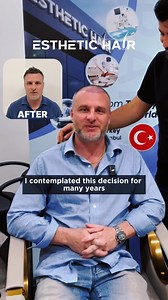 Ready for a transformation? Regain your confidence with Turkey’s #1 hair transplant clinic, offering the latest advancements in hair restoration. 💼 Expert Surgeons: Board-certified professionals committed to excellence. 🏩 State-of-the-Art Clinics: Modern facilities equipped with the latest advancements. 🤝 Personalized Solutions: Tailored treatments for personalized results. 🌏 Discover Turkey: Combine your journey with the rich culture of Turkey. Experience natural-looking hair with cutting-e