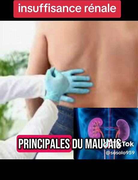 Comprendre l'insuffisance rénale en médecine