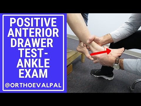 Positive Anterior Drawer Test-Ankle Exam