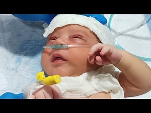 NICUCARE BABYS is live!"4 Days Old Baby with NNJ & High Fever | Abdominal Distension & Phototherapy