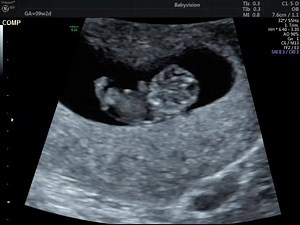 82 reactions · 6 comments | Babyvision on Reels | Facebook