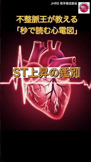 【不整脈医が教える「秒で読む心電図」】