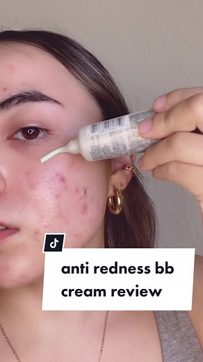 L'Oréal BB Cream Review: Anti-Redness and Professional Results