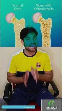 Osteoarthritis vs Osteoporosis: 60-Second Breakdown — Symptoms, Causes, Treatments