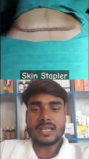 best suture method skin stapler #skinstapler​ #viralvideo​ #shorts​
