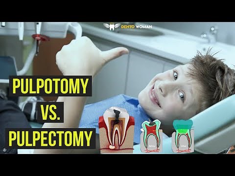 Pulpotomy Vs. Pulpectomy