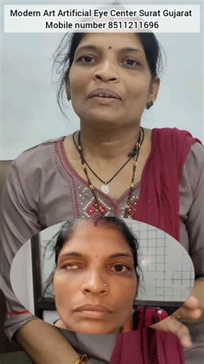 Modern Art Artificial Eye Center on Instagram: "बन सको तो किसी की हंसने की वजह बनो, रुला तो कोई भी देता है "कभी बेटी, कभी पत्नी तो कभी माँ बनकर, हर किरदार बखूबी निभाती है, वो औरत ही है जो अपनों की खुशी के लिए अपने गम हंसकर पी जाती है।" Best Artificial eye center Artificial Eye Treatment in Gujarat and nearby states since 2012. Modern Art Artificial Eye Center Surat Gujarat Contact us at 8511211696 #artificialeye #prostheticeye #नकली_आंख #कृत्रिमडोळा #motivation"