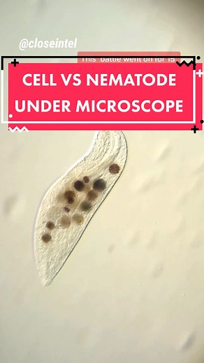 Epic Cell Battle: Nematode vs Cell Under Microscope