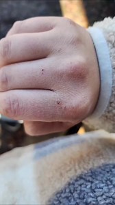 I am so happy my solid body butter sticks are helping those with dry skin, especially Littles. That is exactly why I started making these so people with dry skin could get some relief with lotion that didn't feel like lotion! #lotion #skincare #dryskin | Ensitivityen