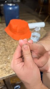 6.5K views · 17 reactions |  You won't believe what came out of this one... #pimplepop #satisfying | Pimple Popping | Facebook