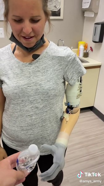 Powering a Prosthetic Hand: Tips and Techniques