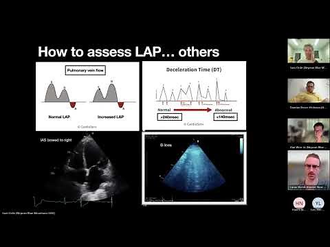Echo guided assessment of left atrial pressure (LAP)