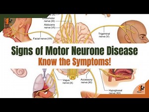 Understanding Motor Neurone Disease: Key Signs and Symptoms to Know