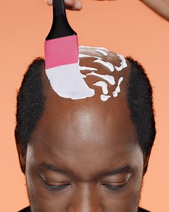 Not too fond of hair transplants? Ever heard of man weaves? Check out these two transformations! | Fuel Factory