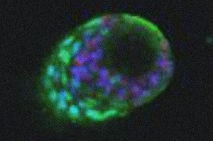 Scientists Develop First 3D Mammary 'Organoid' | Cancer