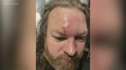 Disneyland brawl suspect urged to come forward