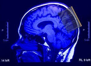 バイオメディカルデバイス - オックスフォード・インストゥルメンツ