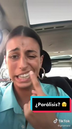 Understanding Facial Paralysis: Symptoms and Insights