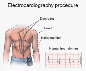 EKG Test NYC | Electrocardiogram Doctor Manhattan, New York