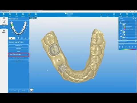 RealGUIDE Software: Reconstruction Setup- Part 4