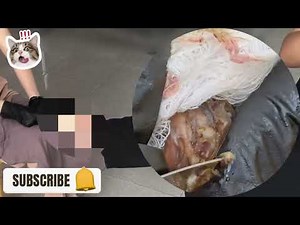 😱 Severe Jigger Attack – Rotten Foot Layers Removed! #MT130