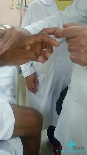 Sinal de Hoffmann: como fazer e entender. #estudantedemedicina #medicina #neurologia