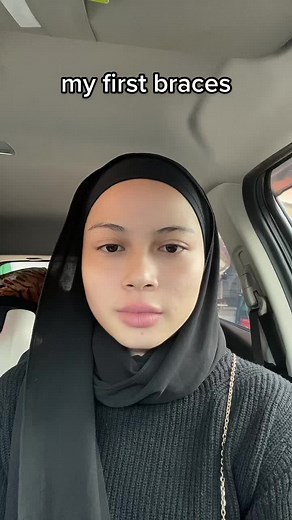 #braces #damonselfligating