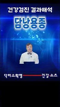 건강검진 담낭 용종 발견? '1cm'가 운명을 바꿉니다! ⚠️