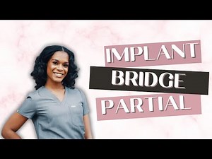 Implant vs Bridge vs Partial – Which Tooth Replacement Is Right for You? | La Luxe Dental DC