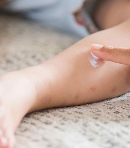 15 Possible Uses Of Calamine Lotion For Babies