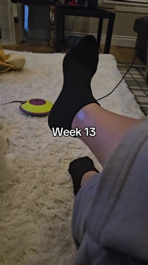 ROM progress after ankle surgery (ORIF) #anklebreakers #brokenankle #orif #physiotherapy #recovery