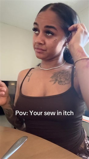 How to Relieve Itchiness After a Sew-In Install