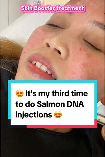 Transform Your Skin with Salmon DNA Injections