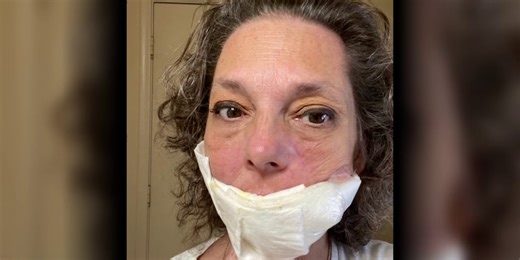 Arizona woman shares journey through rare head, neck cancer diagnosis